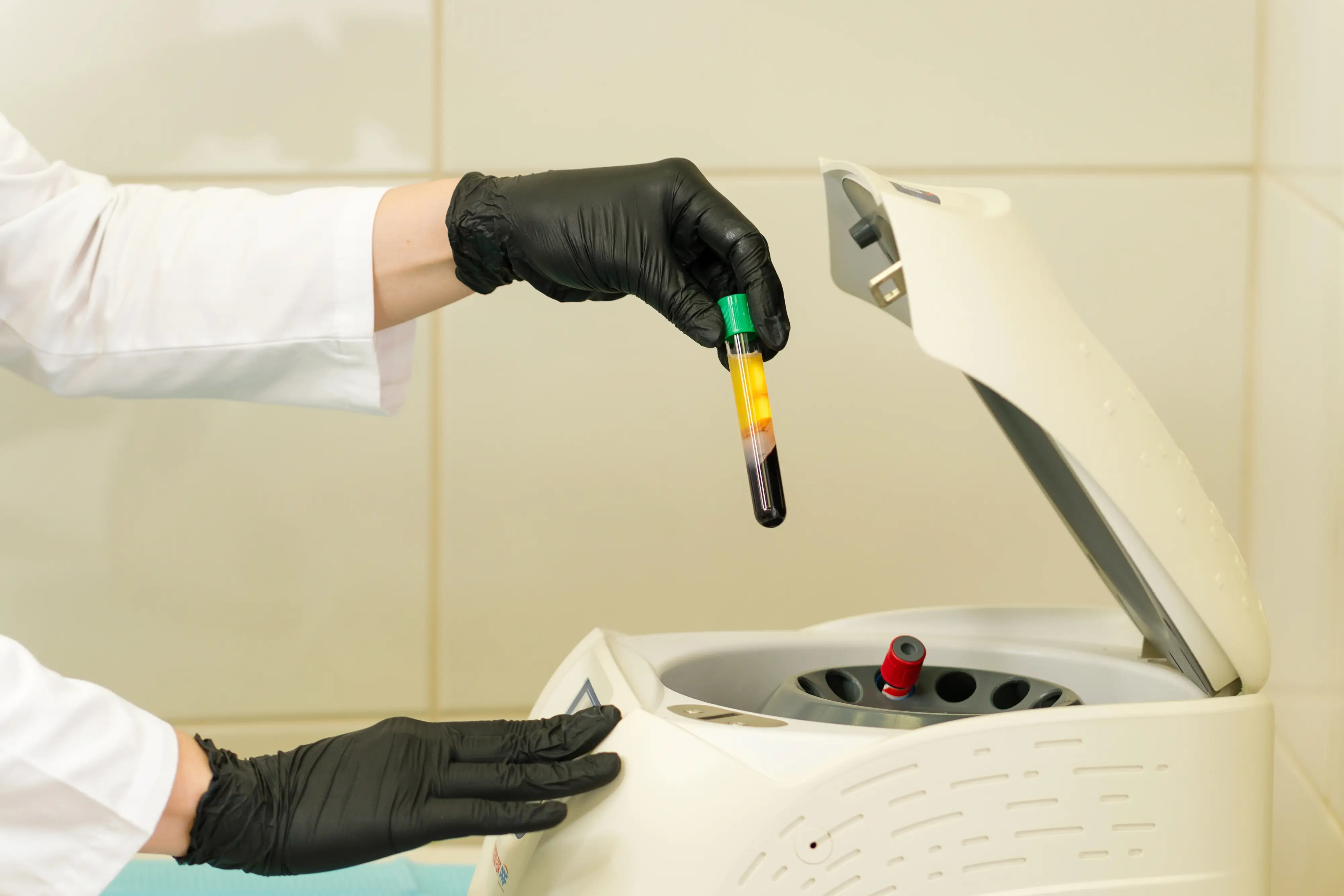 PRP - Plasma Rico en Plaquetas